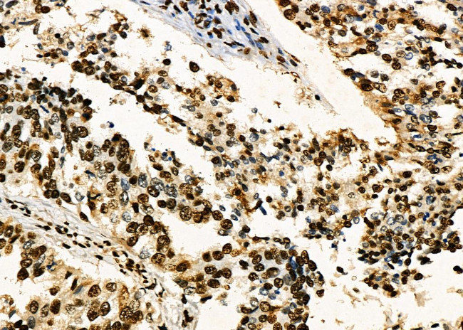 PRKAR1B Antibody in Immunohistochemistry (Paraffin) (IHC (P))