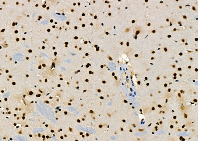 PRKAR1B Antibody in Immunohistochemistry (Paraffin) (IHC (P))