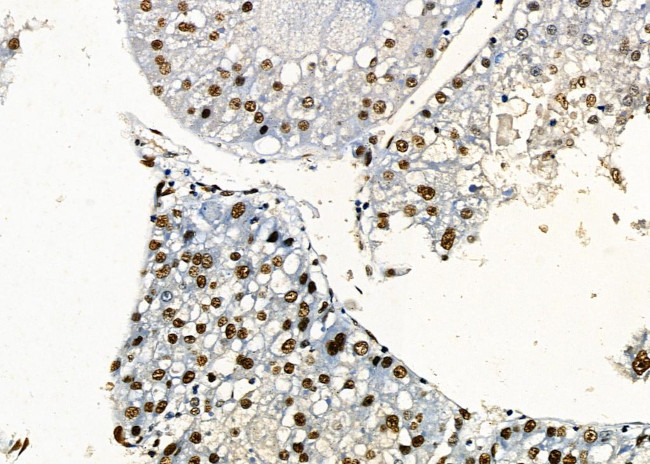 PRKAR1B Antibody in Immunohistochemistry (Paraffin) (IHC (P))