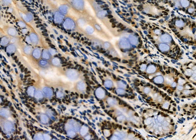 PRKAR1B Antibody in Immunohistochemistry (Paraffin) (IHC (P))