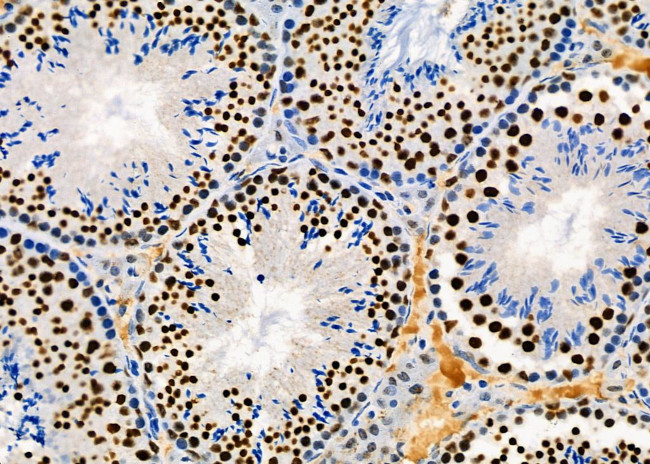 PRKAR1B Antibody in Immunohistochemistry (Paraffin) (IHC (P))