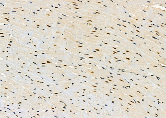 PRKAR1B Antibody in Immunohistochemistry (Paraffin) (IHC (P))