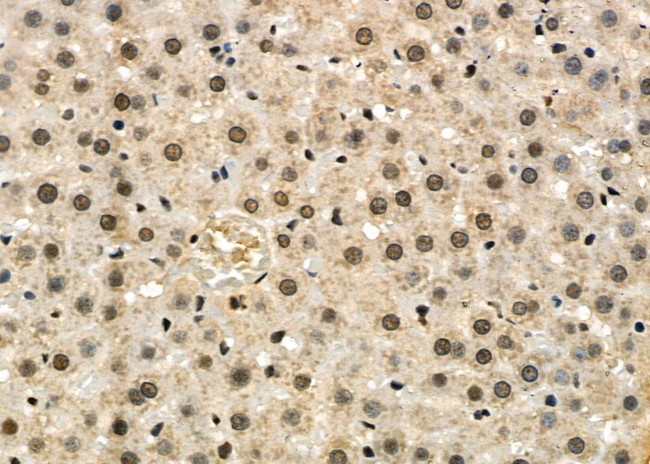 PRKAR1B Antibody in Immunohistochemistry (Paraffin) (IHC (P))