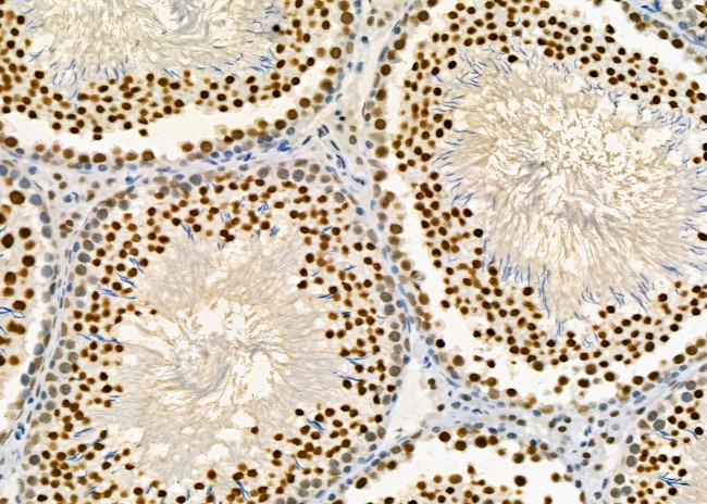 PRKAR1B Antibody in Immunohistochemistry (Paraffin) (IHC (P))