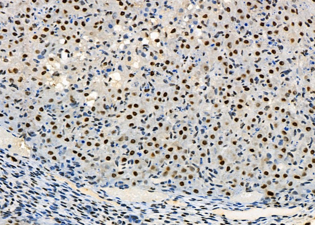 PRKAR1B Antibody in Immunohistochemistry (Paraffin) (IHC (P))