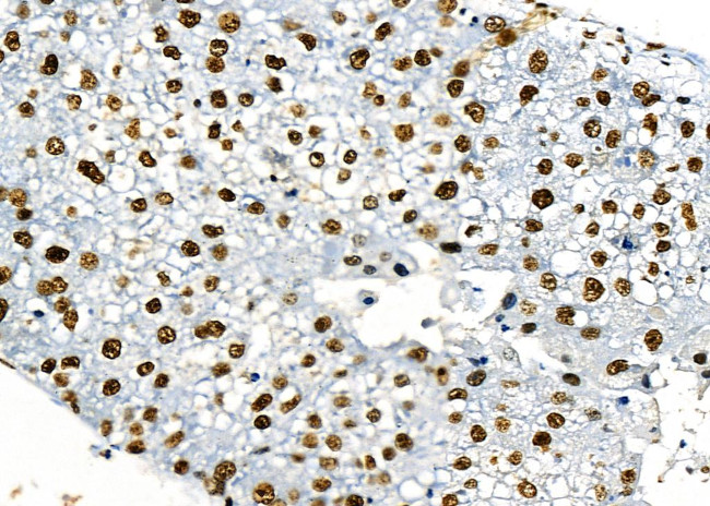 PRKAR1B Antibody in Immunohistochemistry (Paraffin) (IHC (P))