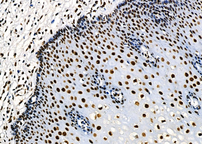 PRKAR1B Antibody in Immunohistochemistry (Paraffin) (IHC (P))