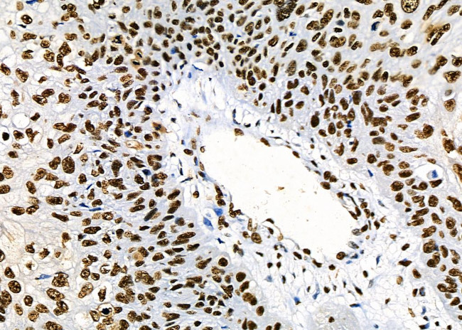 PRKAR1B Antibody in Immunohistochemistry (Paraffin) (IHC (P))