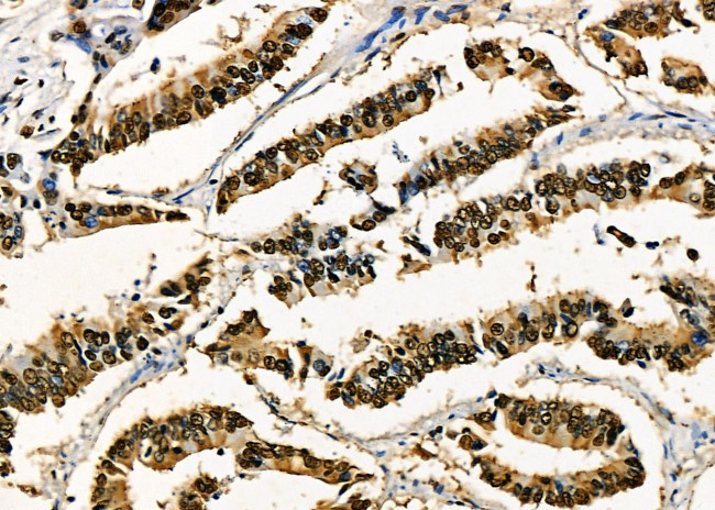 PRKAR1B Antibody in Immunohistochemistry (Paraffin) (IHC (P))