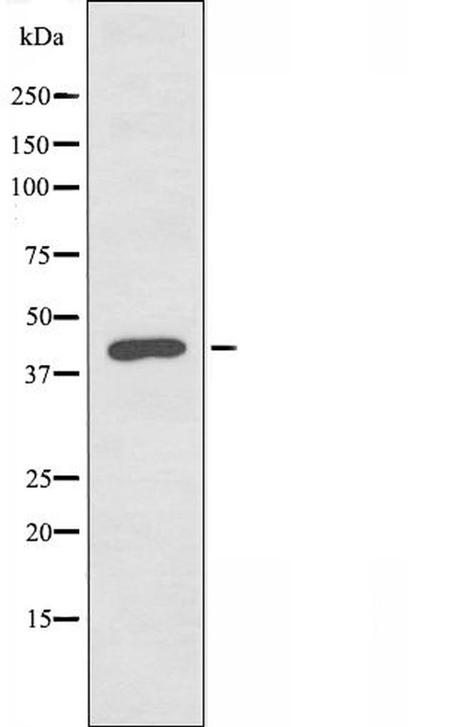 PRKAR1B Antibody in Western Blot (WB)