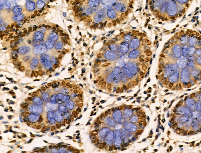 PITX1 Antibody in Immunohistochemistry (Paraffin) (IHC (P))