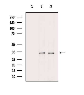 PITX1 Antibody in Western Blot (WB)