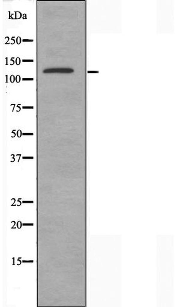 MN1 Antibody in Western Blot (WB)