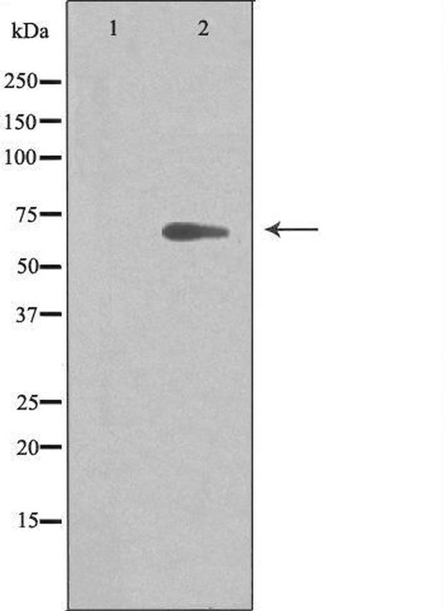 ARMCX2 Antibody in Western Blot (WB)