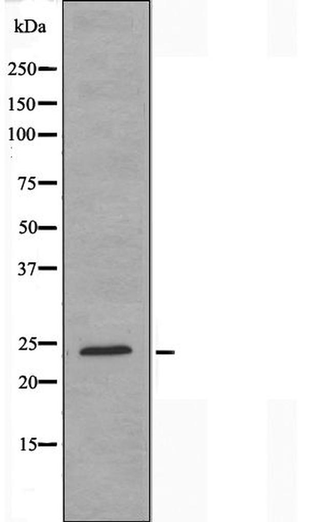 MOB4A Antibody in Western Blot (WB)