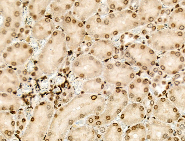 PPP1R14C Antibody in Immunohistochemistry (Paraffin) (IHC (P))