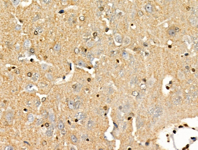 PPP1R14C Antibody in Immunohistochemistry (Paraffin) (IHC (P))