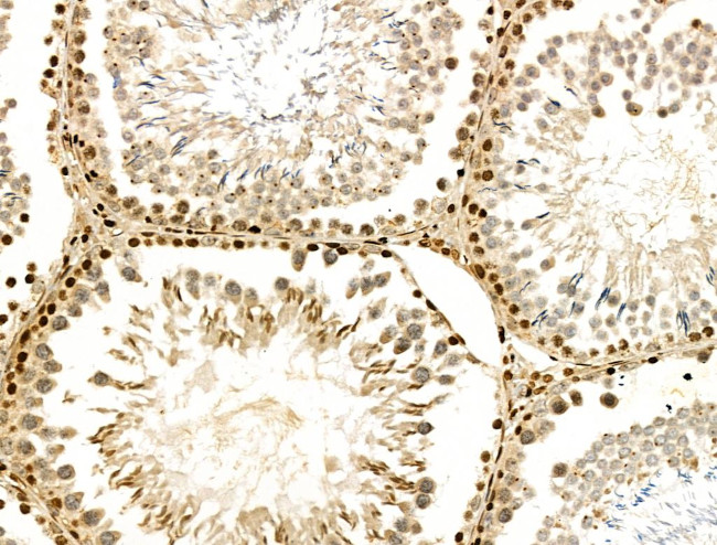 PPP1R14C Antibody in Immunohistochemistry (Paraffin) (IHC (P))