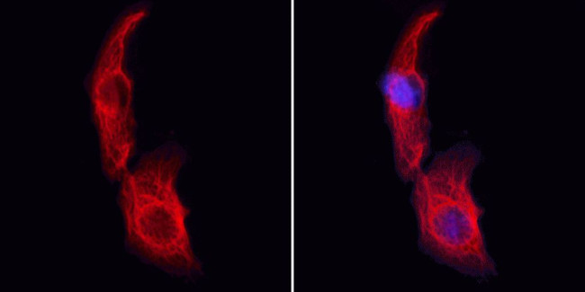 SMG7 Antibody in Immunocytochemistry (ICC/IF)