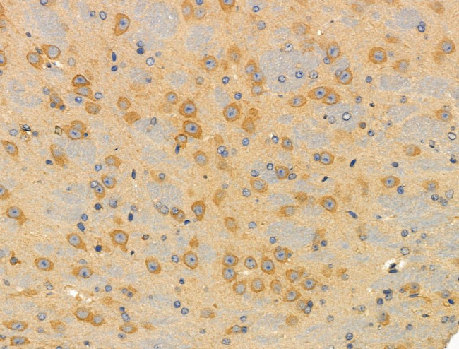 SMG7 Antibody in Immunohistochemistry (Paraffin) (IHC (P))