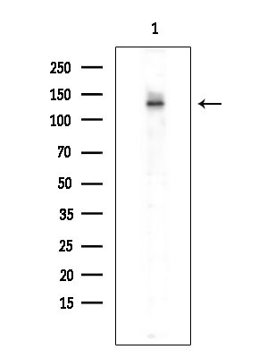 SMG7 Antibody in Western Blot (WB)