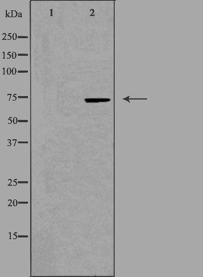 BRF1 Antibody in Western Blot (WB)