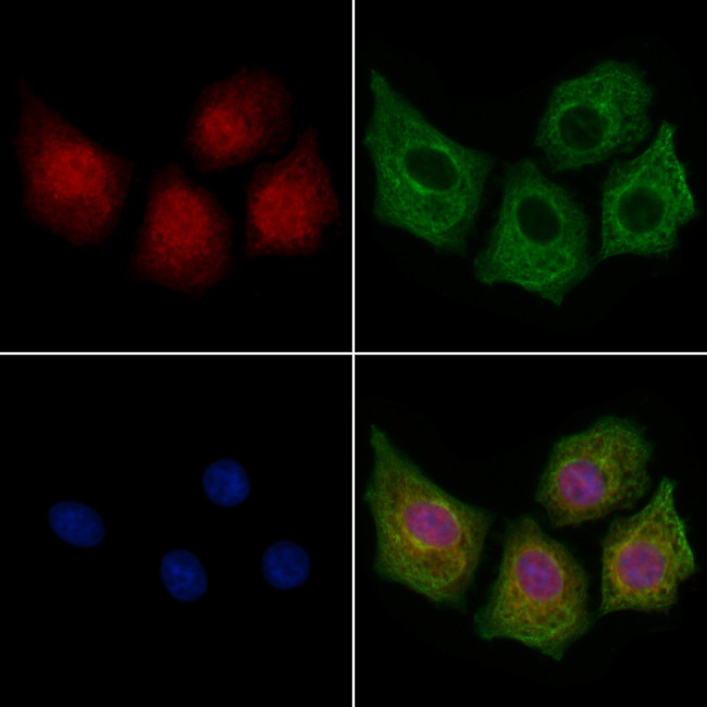 ITPKC Antibody in Immunocytochemistry (ICC/IF)