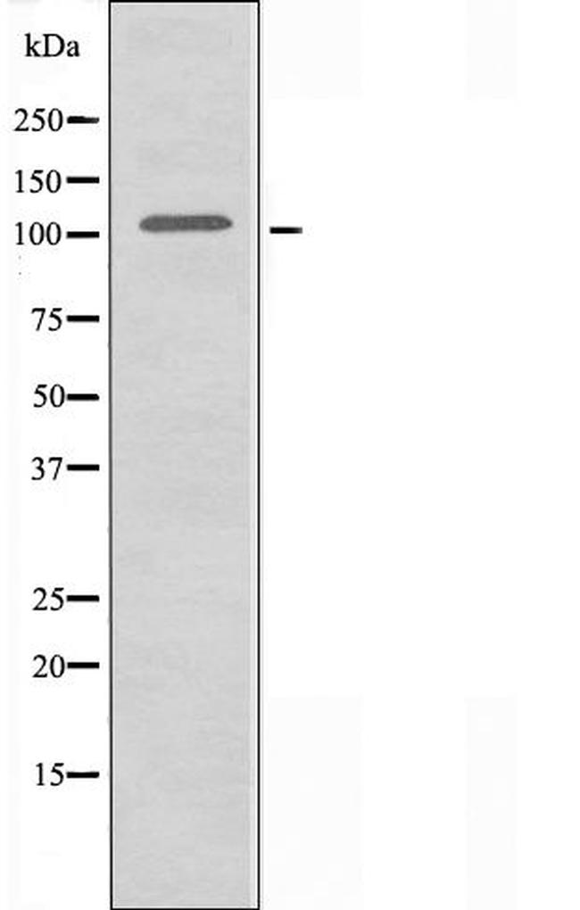 ITPKC Antibody in Western Blot (WB)