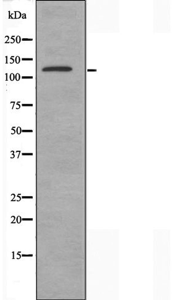 ALPK1 Antibody in Western Blot (WB)