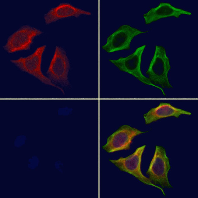 Adenylate Cyclase 4 Antibody in Immunocytochemistry (ICC/IF)