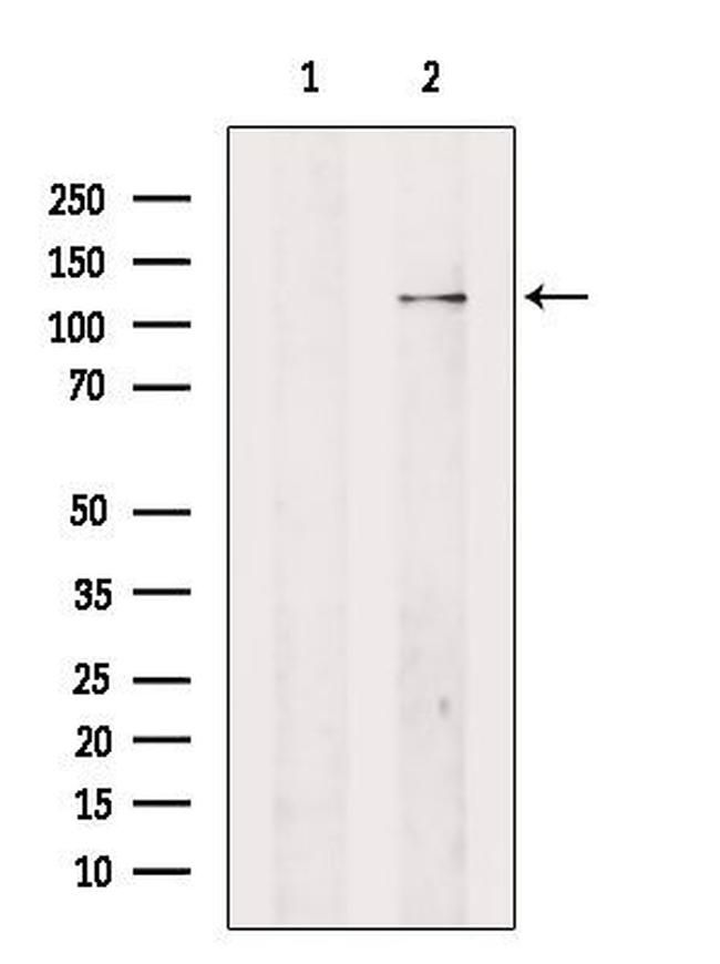 Adenylate Cyclase 4 Antibody in Western Blot (WB)