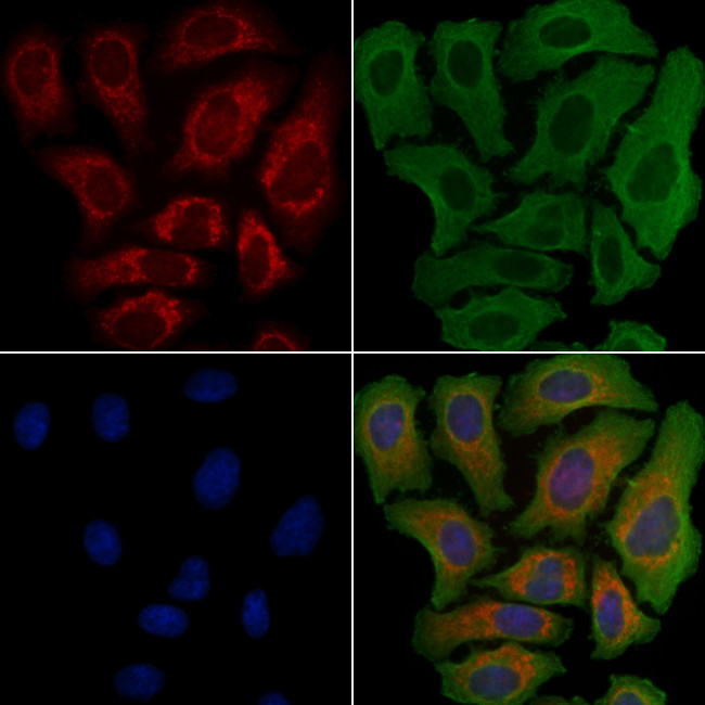 CYP39A1 Antibody in Immunocytochemistry (ICC/IF)