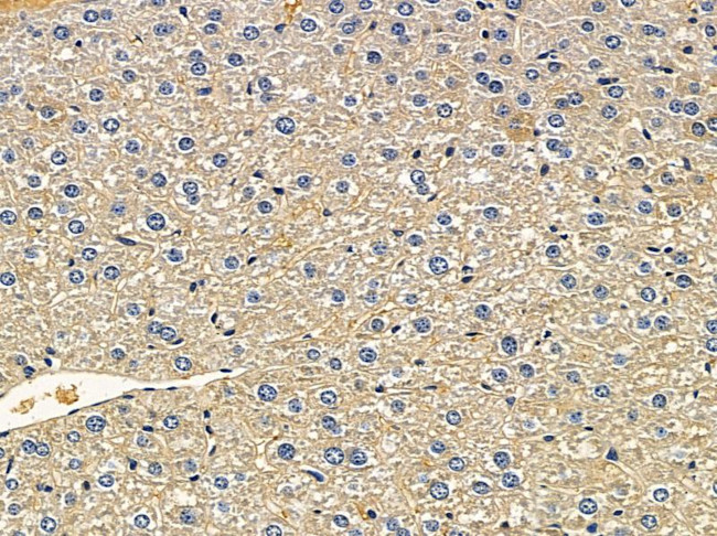 CYP39A1 Antibody in Immunohistochemistry (Paraffin) (IHC (P))