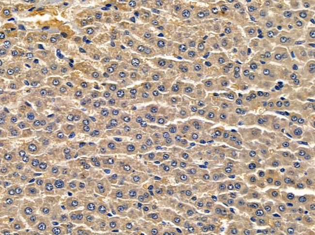 CYP39A1 Antibody in Immunohistochemistry (Paraffin) (IHC (P))