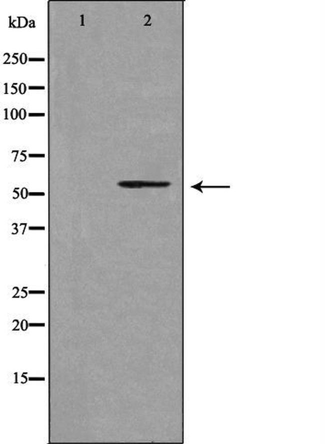 CYP39A1 Antibody in Western Blot (WB)