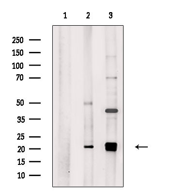 MRPL18 Antibody in Western Blot (WB)