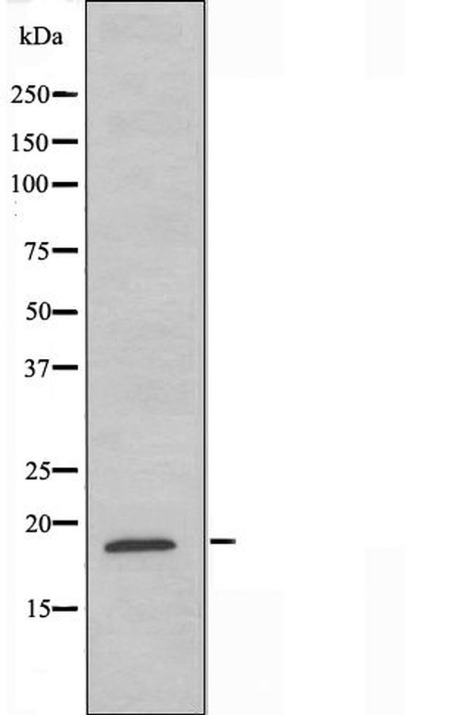 Ubiquitin Antibody in Western Blot (WB)