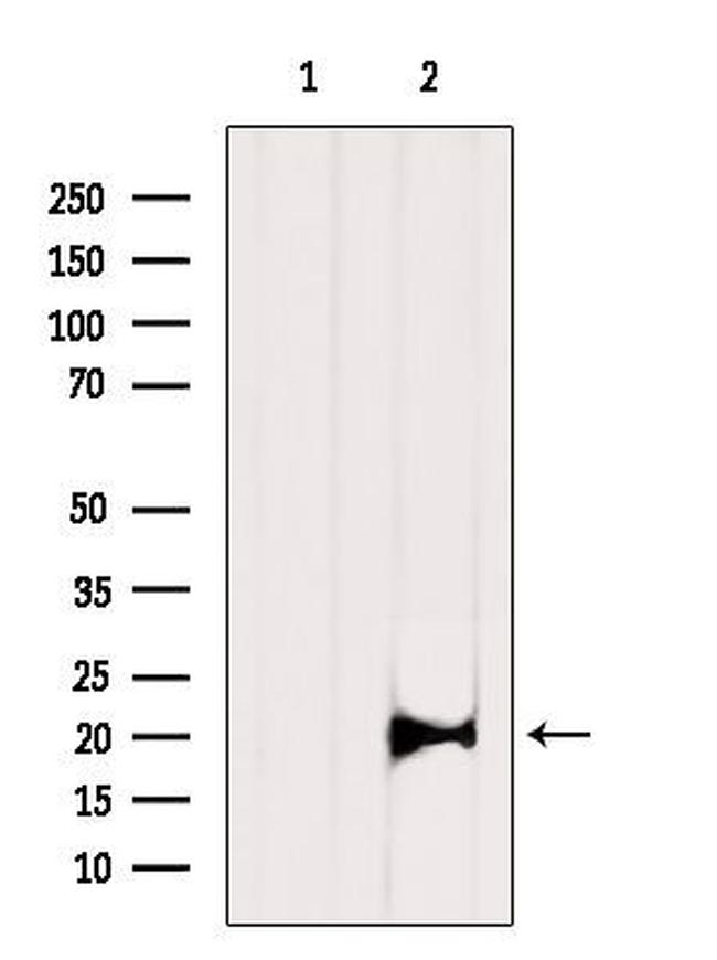 RPL11 Antibody in Western Blot (WB)