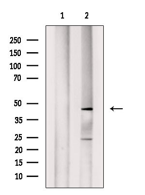 ABHD12 Antibody in Western Blot (WB)