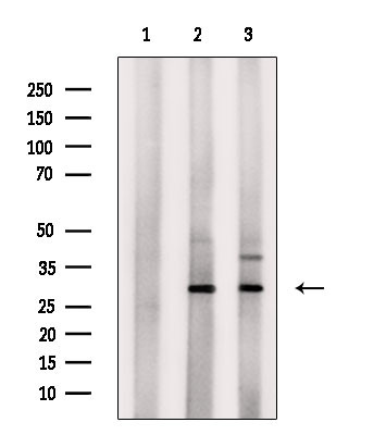 PHAPI2 Antibody in Western Blot (WB)