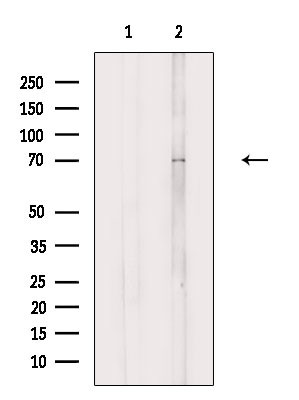 SCNN1D Antibody in Western Blot (WB)