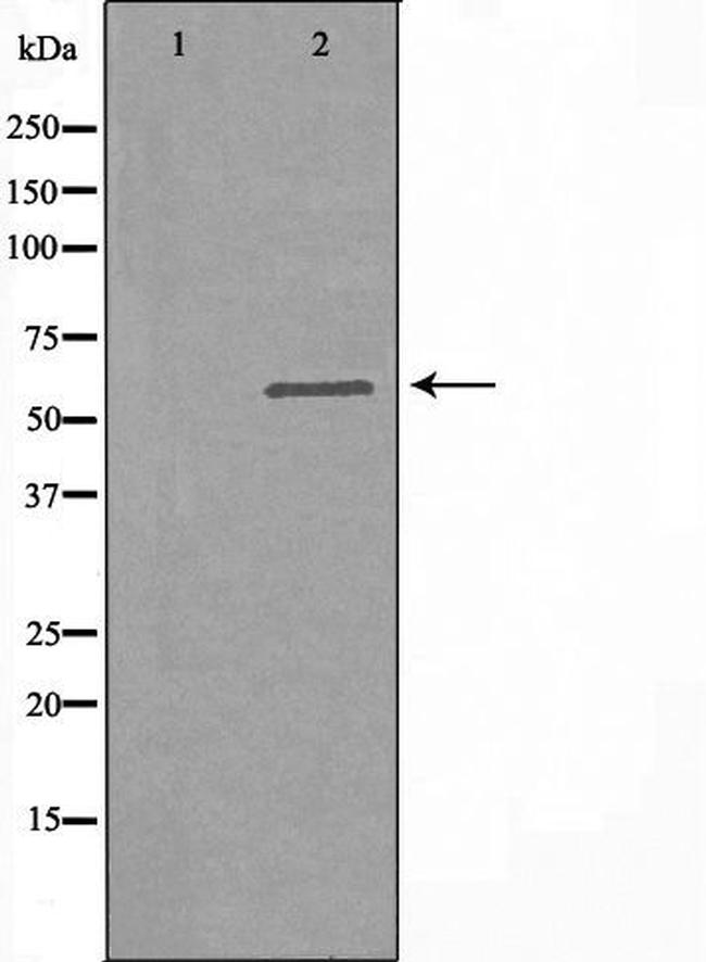 Arylsulfatase F Antibody in Western Blot (WB)