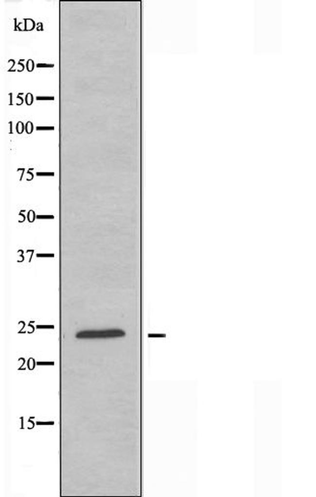 CABP7 Antibody in Western Blot (WB)