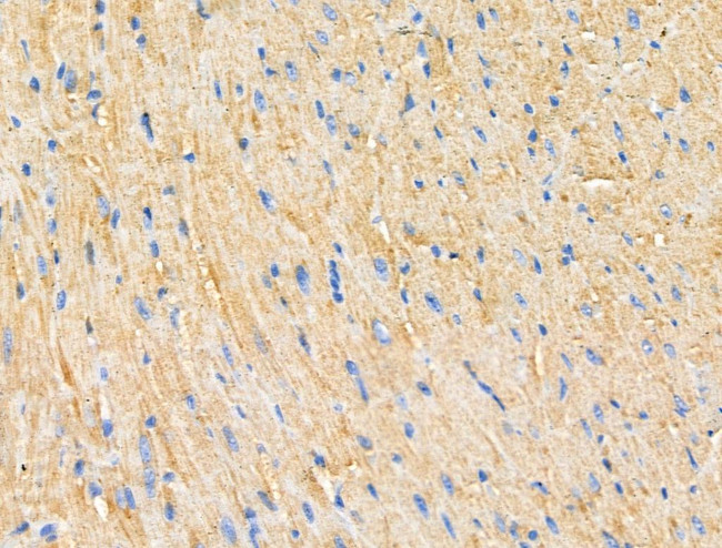 PNPLA8 Antibody in Immunohistochemistry (Paraffin) (IHC (P))