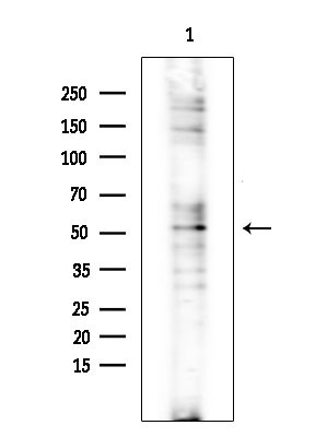 CHST2 Antibody in Western Blot (WB)