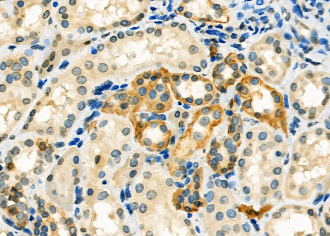 CA12 Antibody in Immunohistochemistry (Paraffin) (IHC (P))