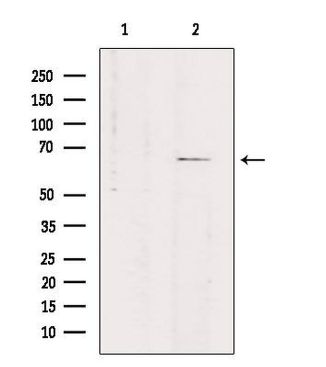 SLC7A4 Antibody in Western Blot (WB)