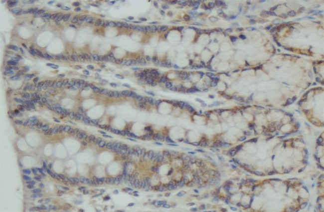 CEP55 Antibody in Immunohistochemistry (Paraffin) (IHC (P))