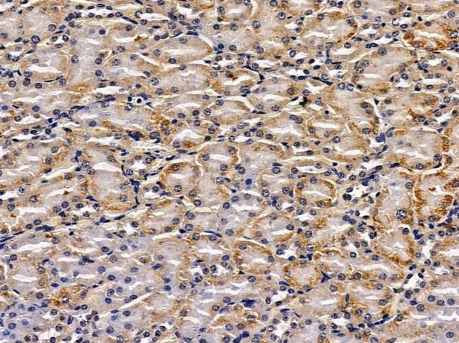 CLCNKA Antibody in Immunohistochemistry (Paraffin) (IHC (P))