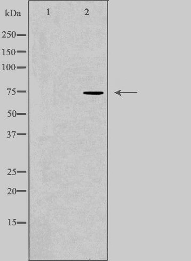 CLCNKA Antibody in Western Blot (WB)